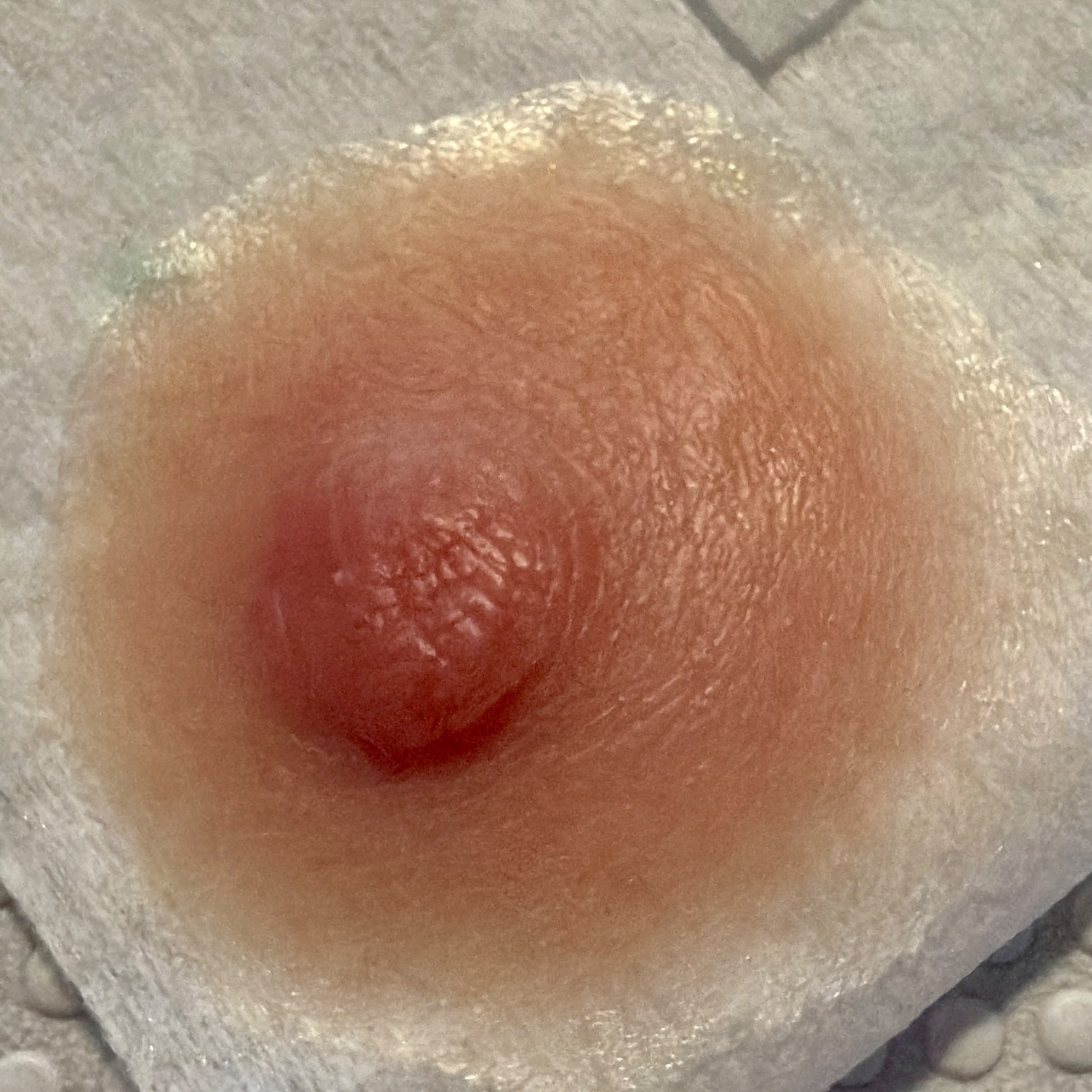 Prótesis de areola-pezón