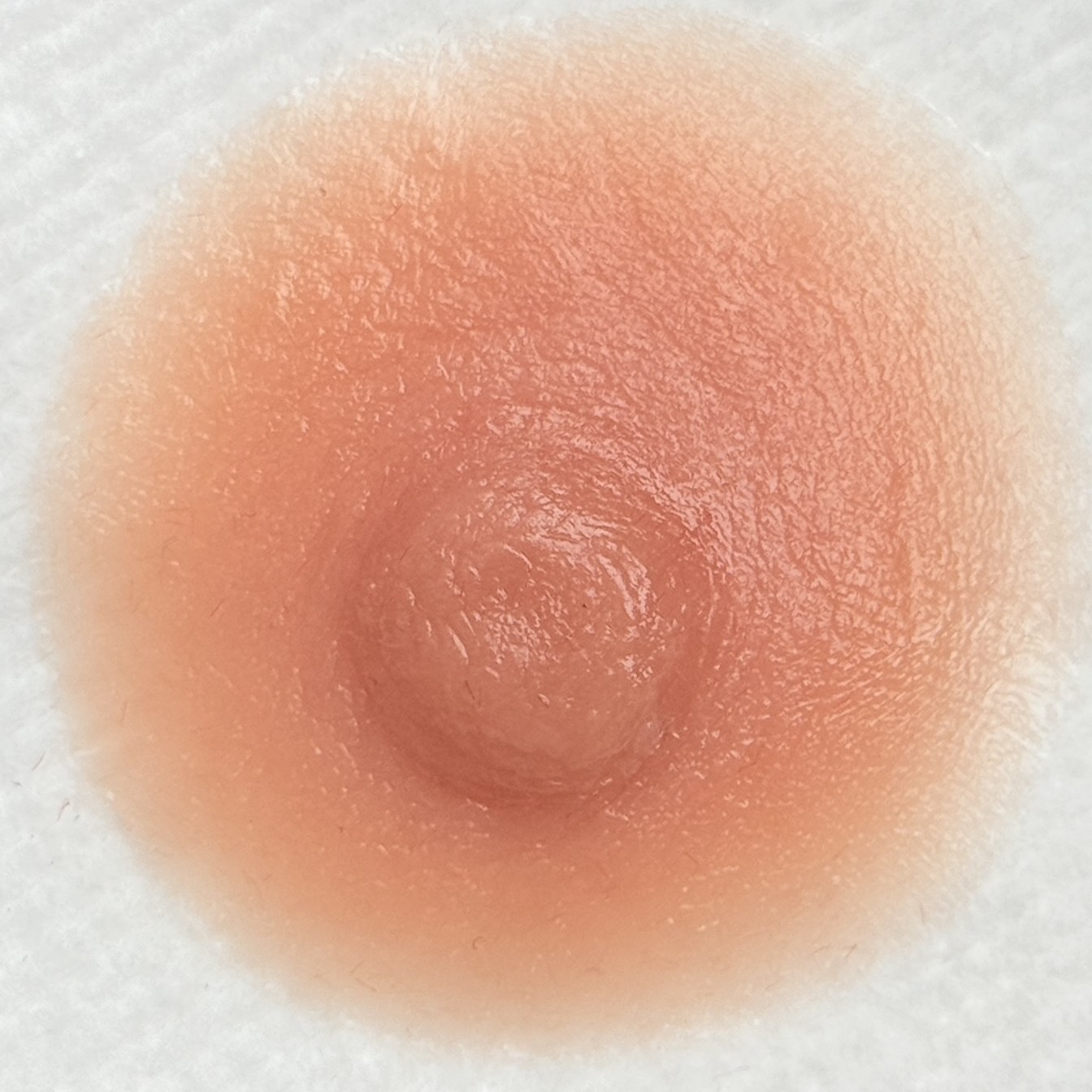 Prótesis de areola-pezón terminada